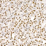 Immunohistochemistry - Anti-Histone H4 (acetyl Lys5 + Lys8 + Lys12 + Lys16) Antibody (A309705) - Antibodies.com