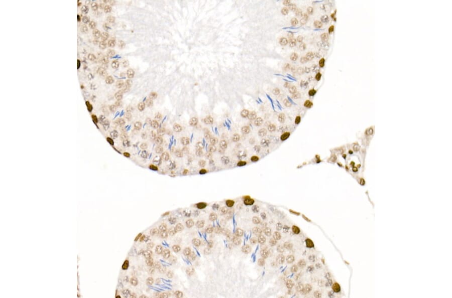 Immunohistochemistry - Anti-Histone H4 (acetyl Lys5 + Lys8 + Lys12 + Lys16) Antibody (A309705) - Antibodies.com