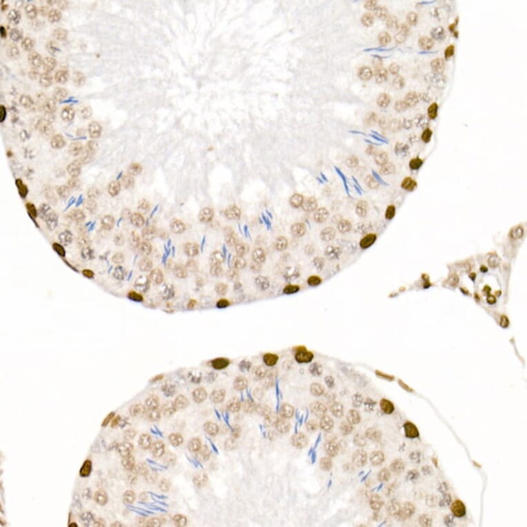 Immunohistochemistry - Anti-Histone H4 (acetyl Lys5 + Lys8 + Lys12 + Lys16) Antibody (A309705) - Antibodies.com