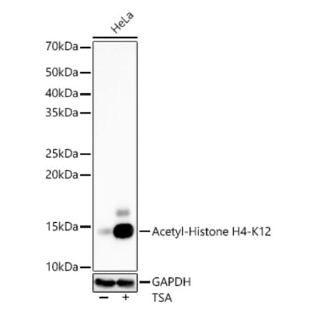 Western Blot - Anti-Histone H4 (acetyl Lys12) Antibody [ARC56881] (A309707) - Antibodies.com