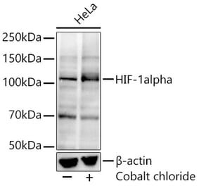 Western Blot - Anti-HIF-1 alpha Antibody [ARC0135] (A309708) - Antibodies.com
