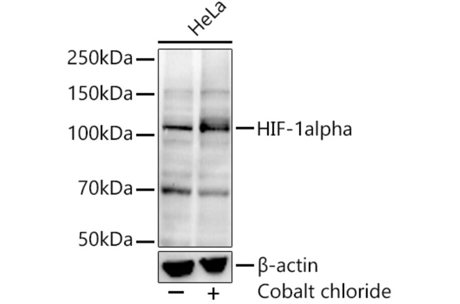 Western Blot - Anti-HIF-1 alpha Antibody [ARC0135] (A309708) - Antibodies.com