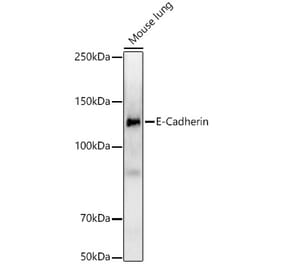Western Blot - Anti-E Cadherin Antibody [ARC57093] (A309709) - Antibodies.com