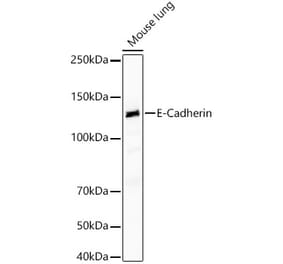 Western Blot - Anti-E Cadherin Antibody [ARC51007 + ARC57093] (A309713) - Antibodies.com
