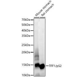 Western Blot - Anti-Estrogen Inducible Protein pS2 Antibody [ARC59782] (A309716) - Antibodies.com