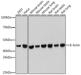 Western Blot - Anti-beta Actin Antibody [ARC5115-01] (A309717) - Antibodies.com