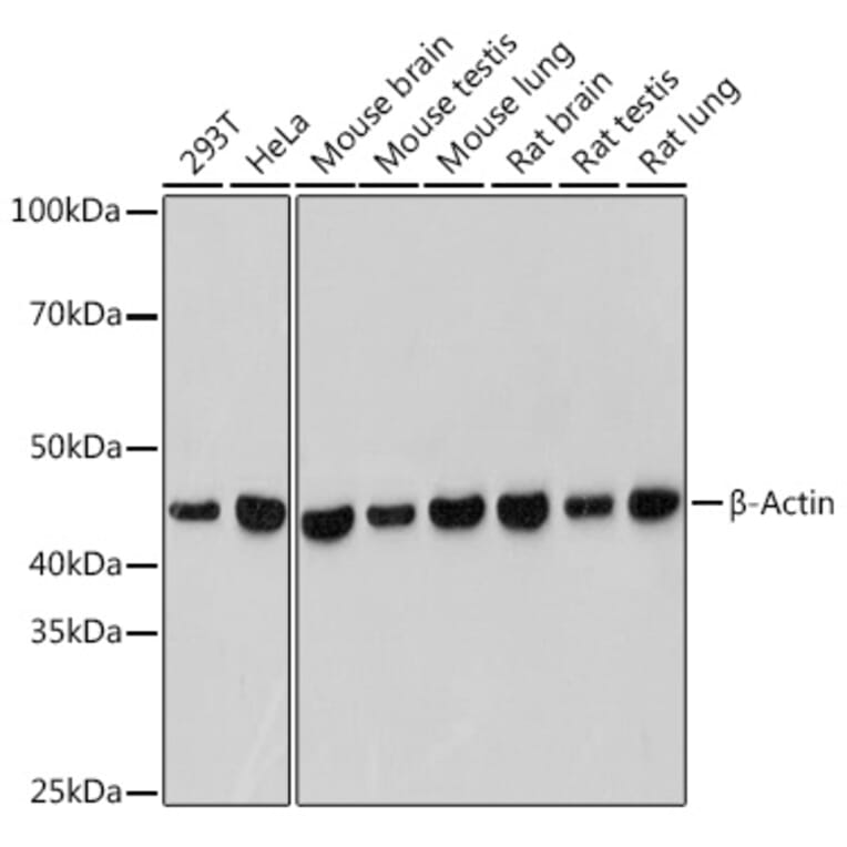 Western Blot - Anti-beta Actin Antibody [ARC5115-01] (A309717) - Antibodies.com