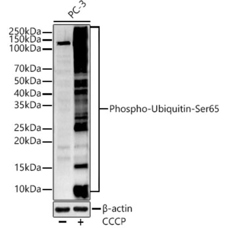 Western Blot - Anti-Ubiquitin (phospho Ser65) Antibody (A309718) - Antibodies.com