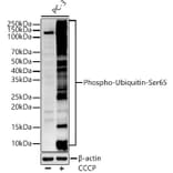 Western Blot - Anti-Ubiquitin (phospho Ser65) Antibody (A309718) - Antibodies.com