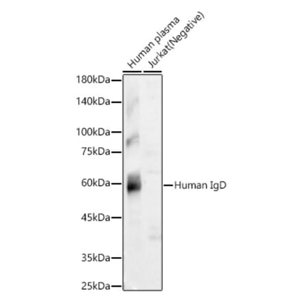 Western Blot - Anti-IgD Antibody [ARC60051] (A309720) - Antibodies.com