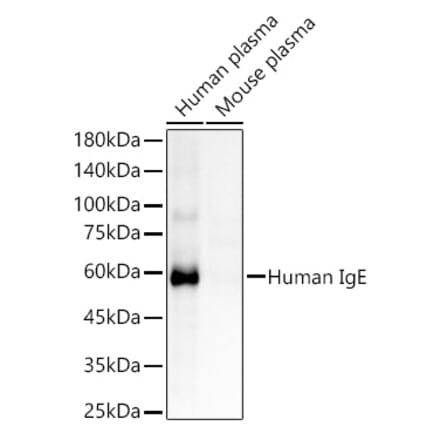 Western Blot - Anti-IgE Antibody [ARC60066] (A309721) - Antibodies.com