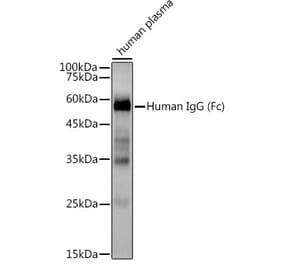 Western Blot - Anti-Human IgG Antibody [ARC2241] (A309722) - Antibodies.com