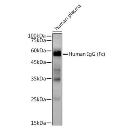 Western Blot - Anti-Human IgG Antibody [ARC2241] (A309722) - Antibodies.com