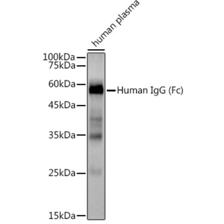 Western Blot - Anti-Human IgG Antibody [ARC2241] (A309722) - Antibodies.com