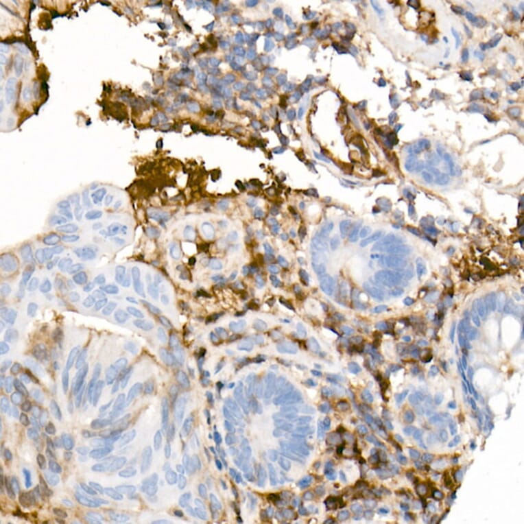 Immunohistochemistry - Anti-Human IgG Antibody [ARC2241] (A309722) - Antibodies.com
