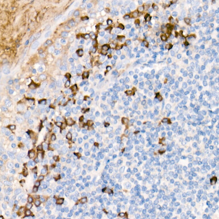 Immunohistochemistry - Anti-Human IgG Antibody [ARC2241] (A309722) - Antibodies.com