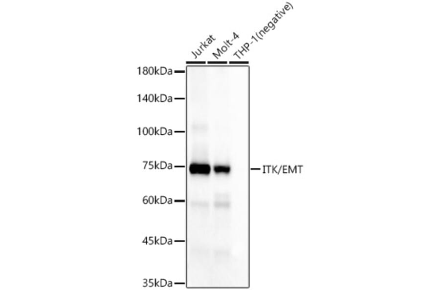 Western Blot - Anti-ITK/EMT Antibody [ARC58362] (A309723) - Antibodies.com