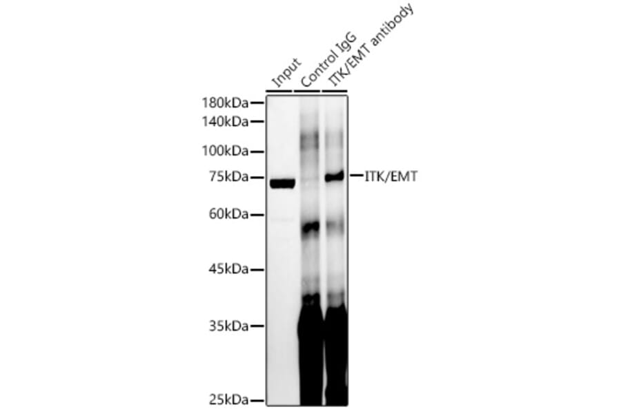Western Blot - Anti-ITK/EMT Antibody [ARC58362] (A309723) - Antibodies.com