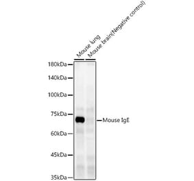 Western Blot - Anti-IgE Antibody [ARC60081] (A309727) - Antibodies.com