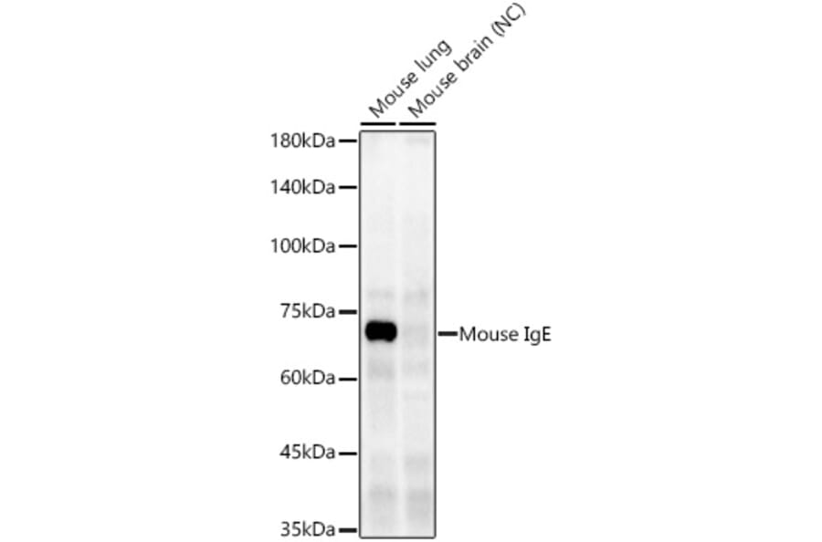 Western Blot - Anti-IgE Antibody [ARC60081] (A309727) - Antibodies.com