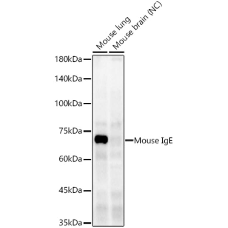 Western Blot - Anti-IgE Antibody [ARC60081] (A309727) - Antibodies.com
