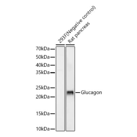 Western Blot - Anti-Glucagon Antibody [ARC56934] (A309735) - Antibodies.com