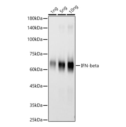 Western Blot - Anti-Interferon beta Antibody [ARC58590] (A309736) - Antibodies.com