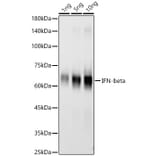 Western Blot - Anti-Interferon beta Antibody [ARC58590] (A309736) - Antibodies.com