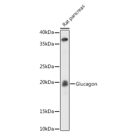 Western Blot - Anti-Glucagon Antibody [ARC0382] (A309737) - Antibodies.com