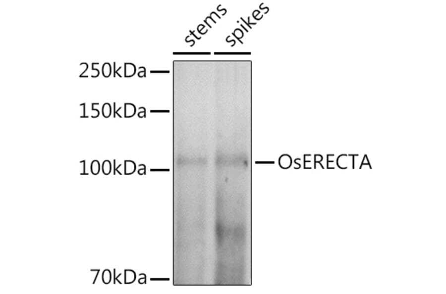 Western Blot - Anti-ER1 Antibody (A309740) - Antibodies.com