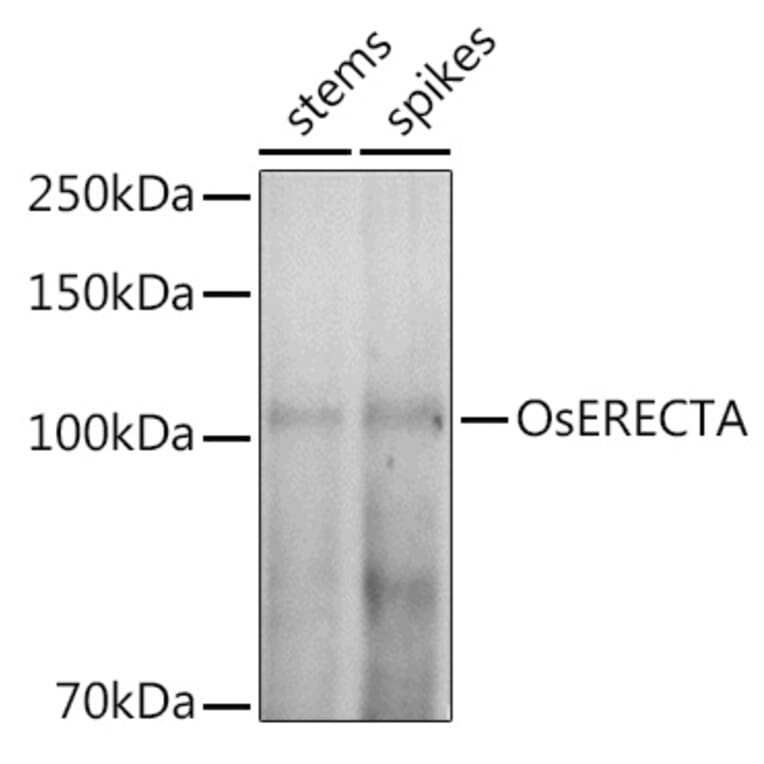 Western Blot - Anti-ER1 Antibody (A309740) - Antibodies.com