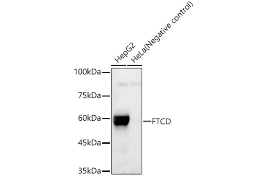 Western Blot - Anti-24(S)-Hydroxycholesterol Antibody (A309754) - Antibodies.com