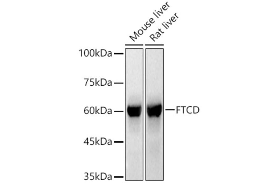 Western Blot - Anti-24(S)-Hydroxycholesterol Antibody (A309754) - Antibodies.com