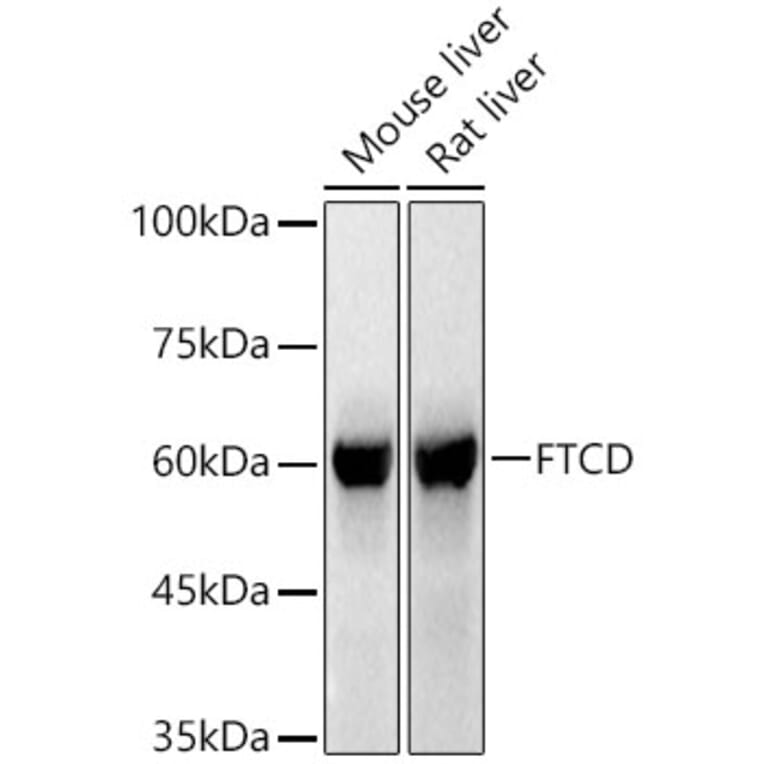 Western Blot - Anti-24(S)-Hydroxycholesterol Antibody (A309754) - Antibodies.com