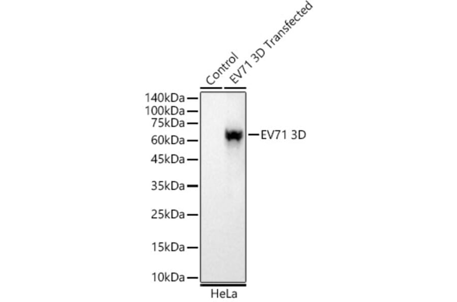 Western Blot - Anti-Enterovirus 71 3D Antibody [ARC58400] (A309755) - Antibodies.com