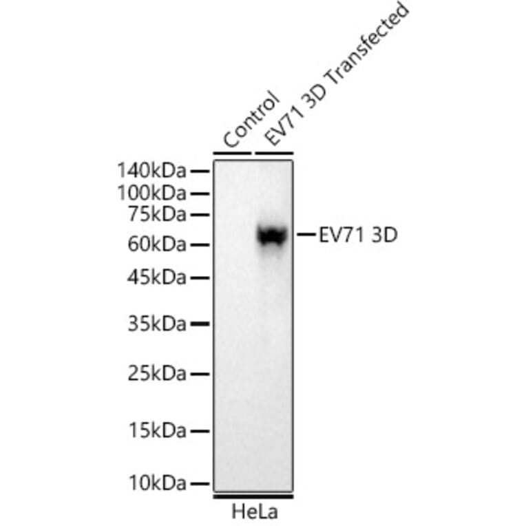 Western Blot - Anti-Enterovirus 71 3D Antibody [ARC58400] (A309755) - Antibodies.com
