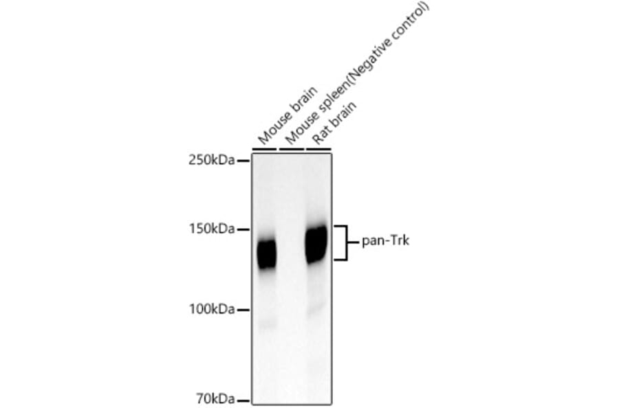 Western Blot - Anti-TrkA + TrkB + TrkC Antibody [ARC59539] (A309759) - Antibodies.com