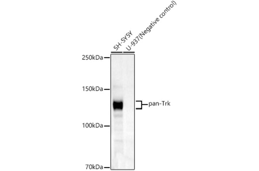 Western Blot - Anti-TrkA + TrkB + TrkC Antibody [ARC59539] (A309759) - Antibodies.com