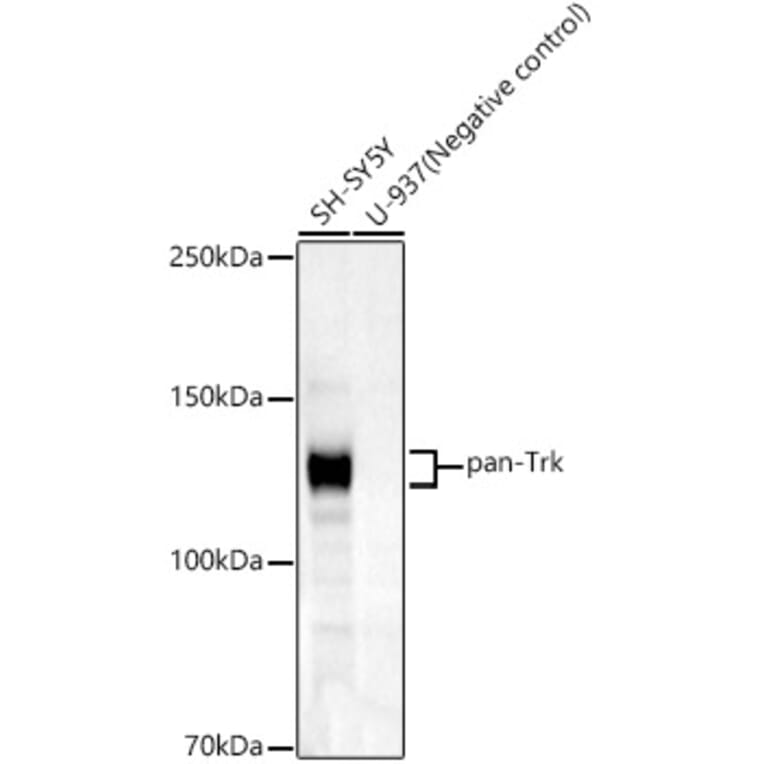 Western Blot - Anti-TrkA + TrkB + TrkC Antibody [ARC59539] (A309759) - Antibodies.com