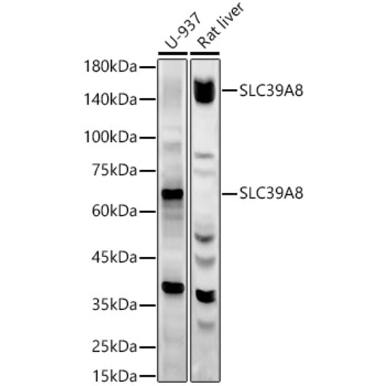 Western Blot - Anti-SLC39A8 Antibody (A309760) - Antibodies.com