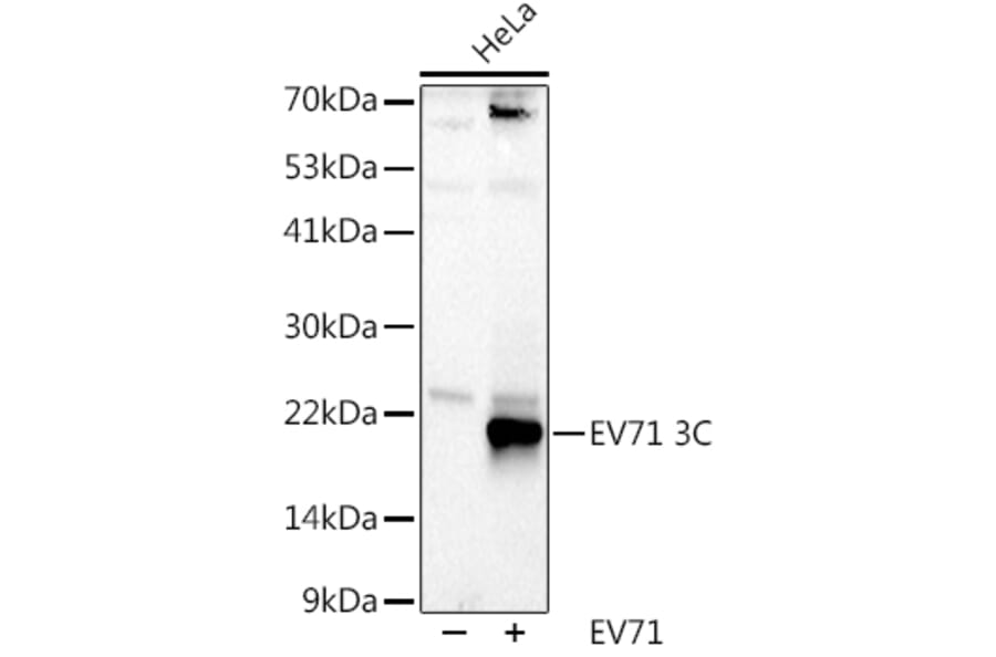 Western Blot - Anti-Enterovirus 71 3D Antibody (A309771) - Antibodies.com