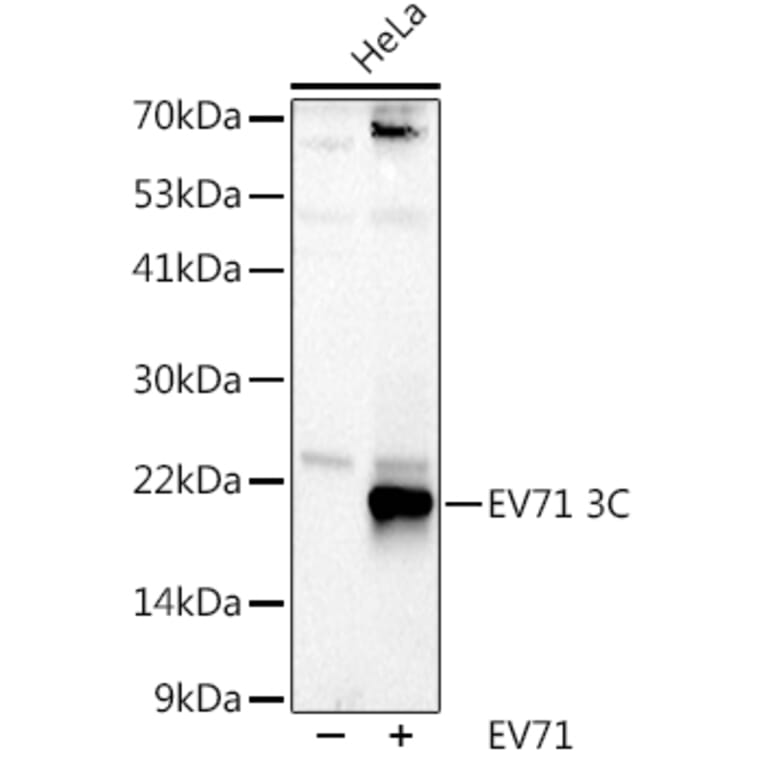 Western Blot - Anti-Enterovirus 71 3D Antibody (A309771) - Antibodies.com