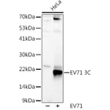 Western Blot - Anti-Enterovirus 71 3D Antibody (A309771) - Antibodies.com