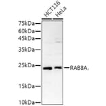 Western Blot - Anti-MBP Tag Antibody [AMC0522] (HRP) (A309778) - Antibodies.com