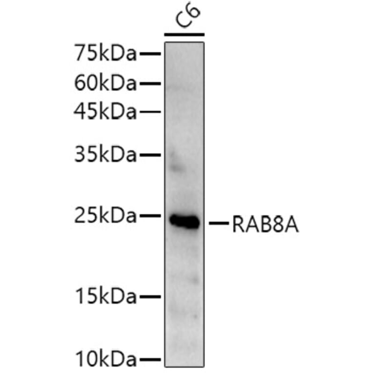 Western Blot - Anti-MBP Tag Antibody [AMC0522] (HRP) (A309778) - Antibodies.com