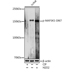 Western Blot - Anti-ASK1 (phospho Ser967) Antibody (A309782) - Antibodies.com