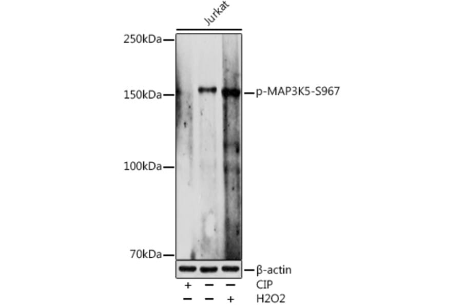 Western Blot - Anti-ASK1 (phospho Ser967) Antibody (A309782) - Antibodies.com