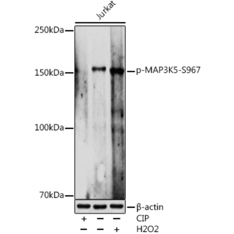 Western Blot - Anti-ASK1 (phospho Ser967) Antibody (A309782) - Antibodies.com