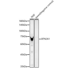 Western Blot - Anti-BTN2A1 Antibody [ARC59656] (A309786) - Antibodies.com