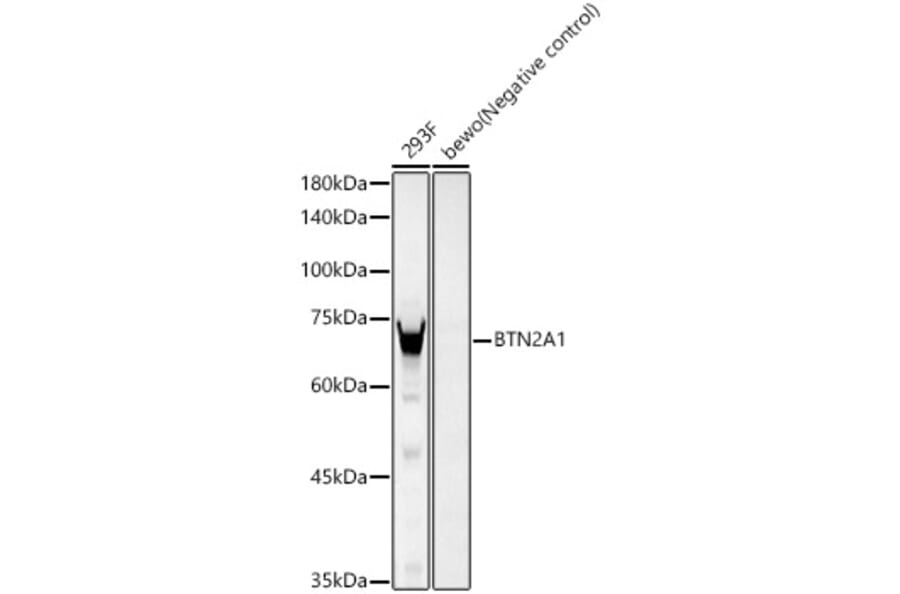 Western Blot - Anti-BTN2A1 Antibody [ARC59656] (A309786) - Antibodies.com